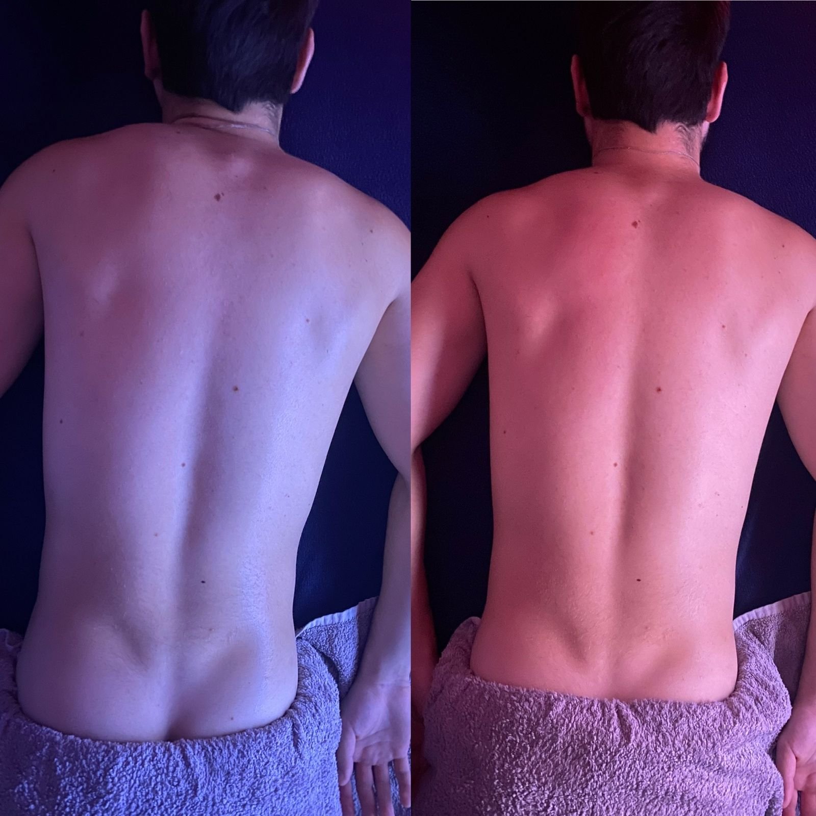 Resultado antes e depois